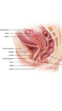Define This: Dyspareunia (Painful Sex)